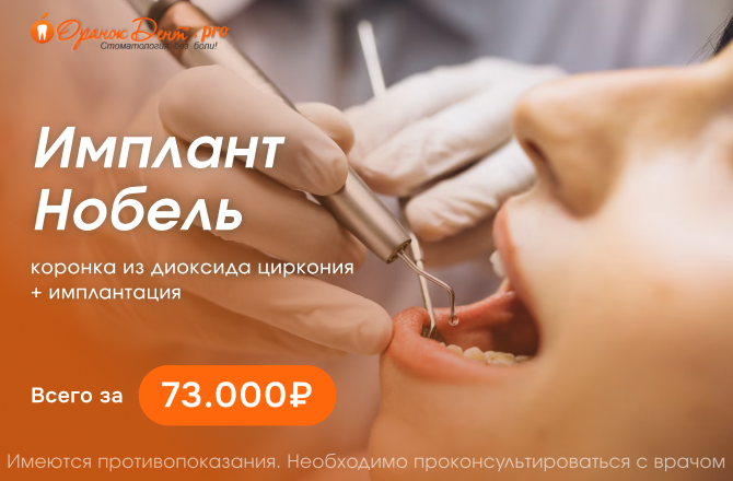 Имплант Нобель всего за 73 000 руб.